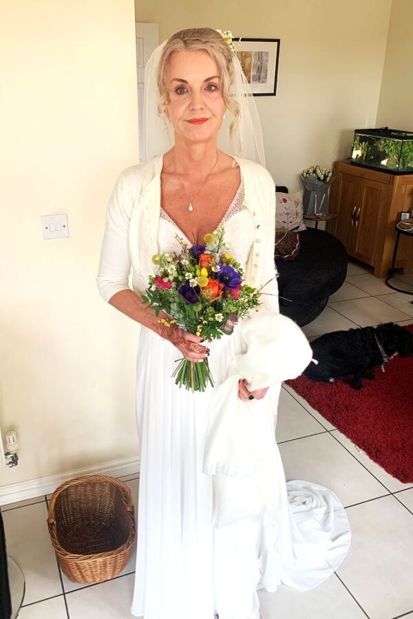 Menopausal eczema almost ruined wedding until a donkey milk salve saved the day!
