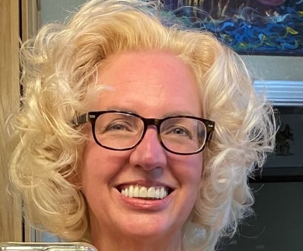 Best rosacea cream for menopause rosacea helped lawyer save face after family mistook it for tipsy cheeks