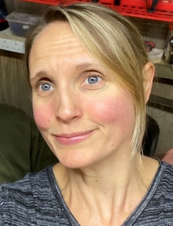 Rosacea sufferer relieves her dry red skin with a serum made from tequila
