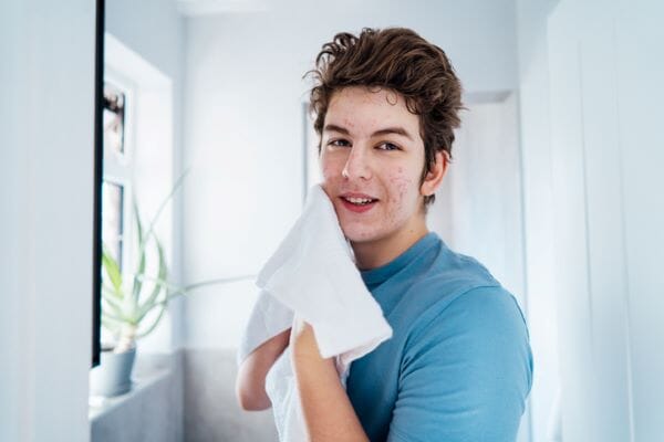 As UK is ranked 8th acne hot spot in the world  - 4 tips to permanently reduce acne breakouts
