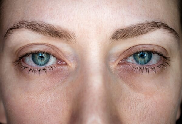 6 tips to avoid sore hay fever eyes