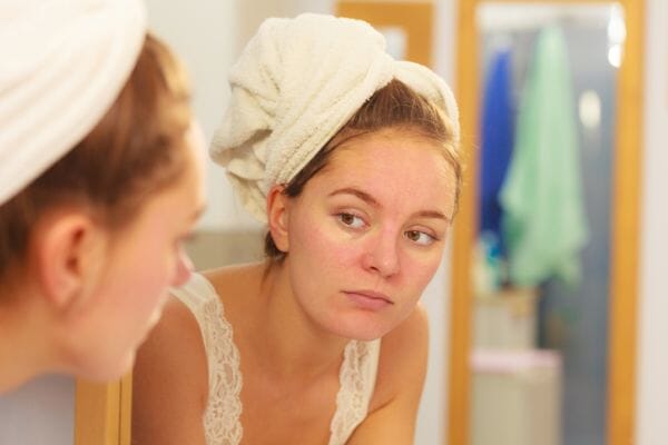 Are you suffering from central heating complexion?