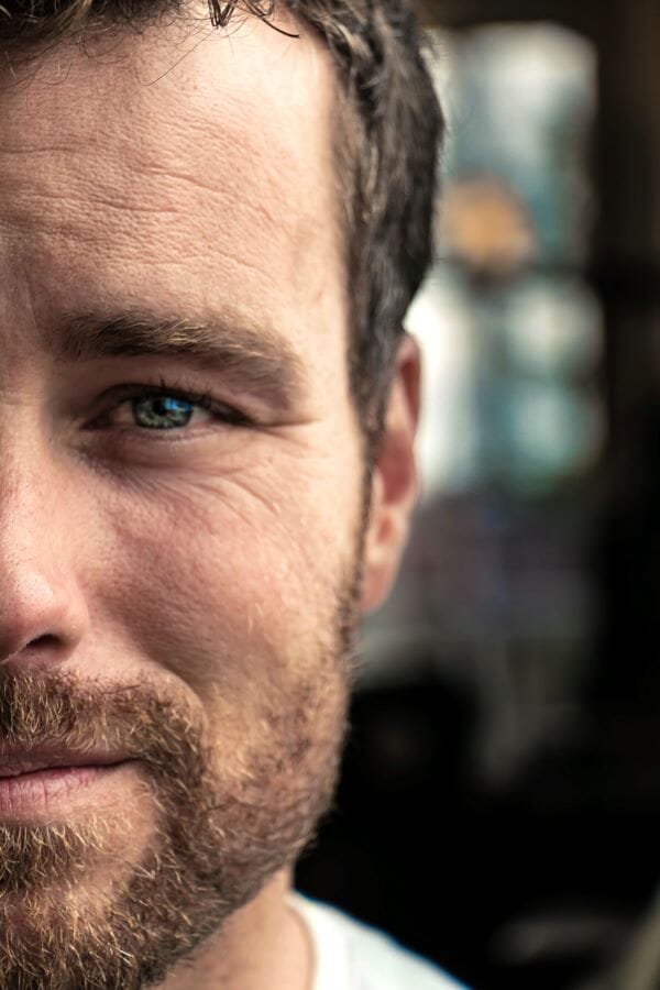 Reasons Why Men with Rosacea Should Wear Concealer