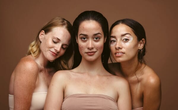 10 types of spots that aren’t acne 