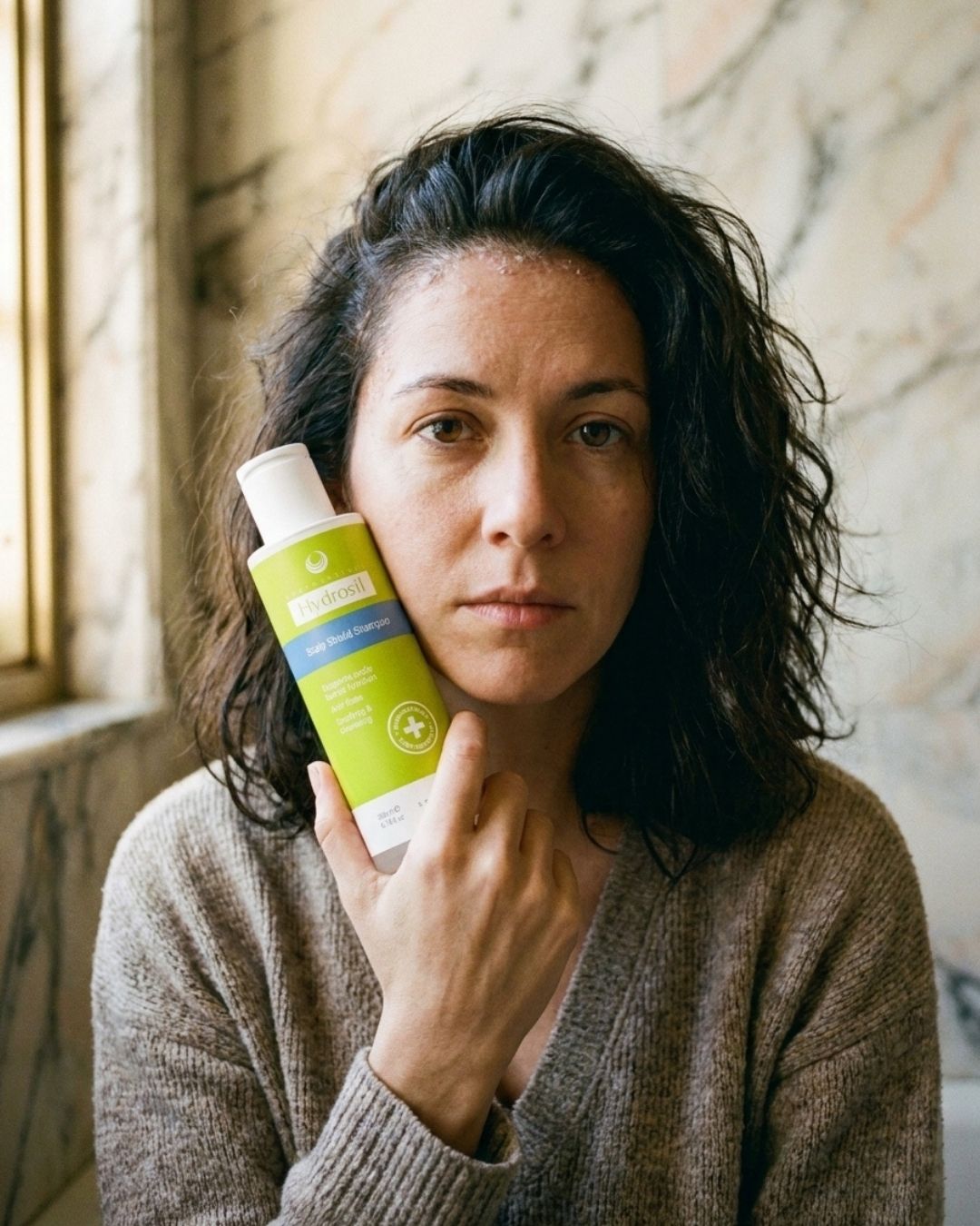 Woman with a dry, flaky scalp holding a 200ml bottle of Hydrosil Scalp Shield Shampoo beside her face